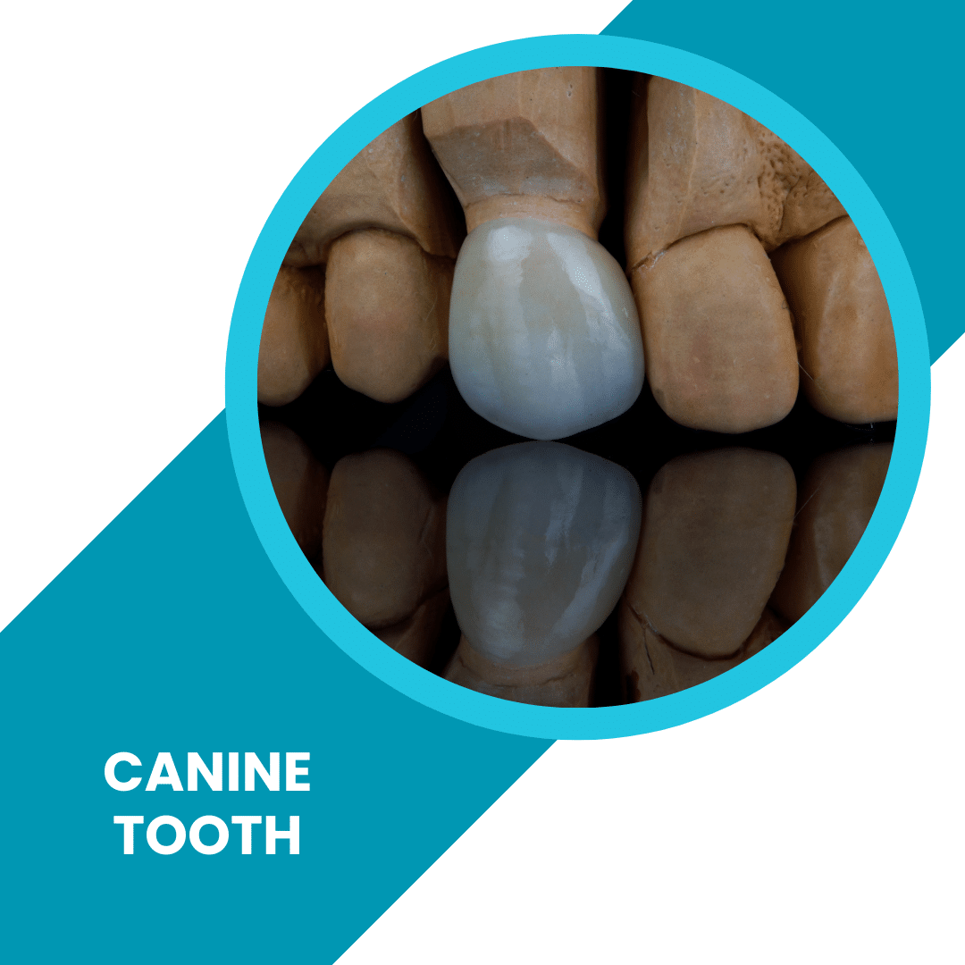 Canine Tooth - FAQ About Canine Teeth and Braces